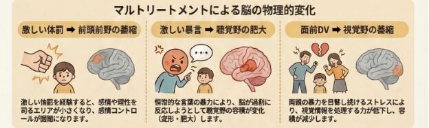 体罰による前頭前野の萎縮、暴言による聴覚野の肥大、面前DVによる視覚野の萎縮